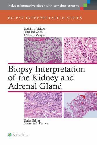 Biopsy interpretation the - biopsy,